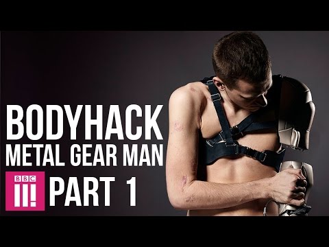 αμυχή σώματος | Metal Gear Man - ΜΕΡΟΣ 1