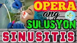 Sinusitis Opera Ba Ang Permanent Solution?