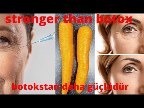 Video: Kui Kaua Võtab Botox Tööle? Ajaskaala Ja Palju Muud