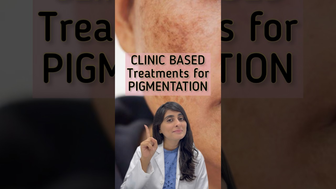 Hyperpigmentation Treatment | Pigmentation Treatment on face | Dark Spots on Face #shorts