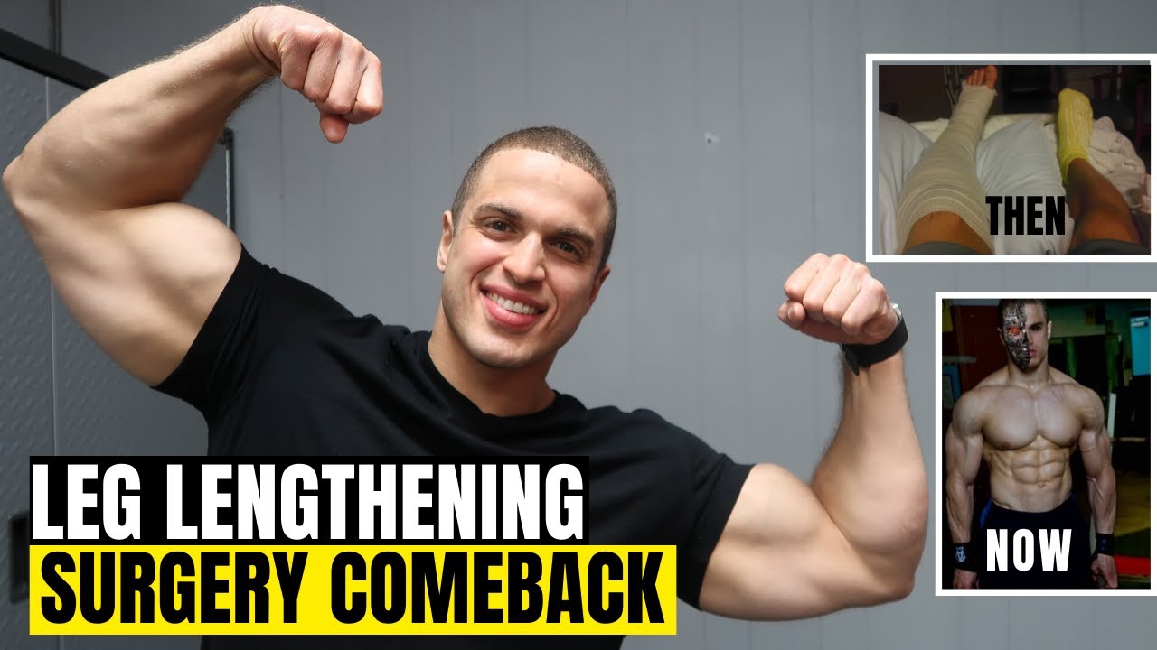 Limb lengthening surgery comeback - regaining your athletic ability