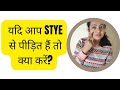 How to get rid of STYE?? स्टाई से छुटकारा कैसे पाएं? #stye #eyes