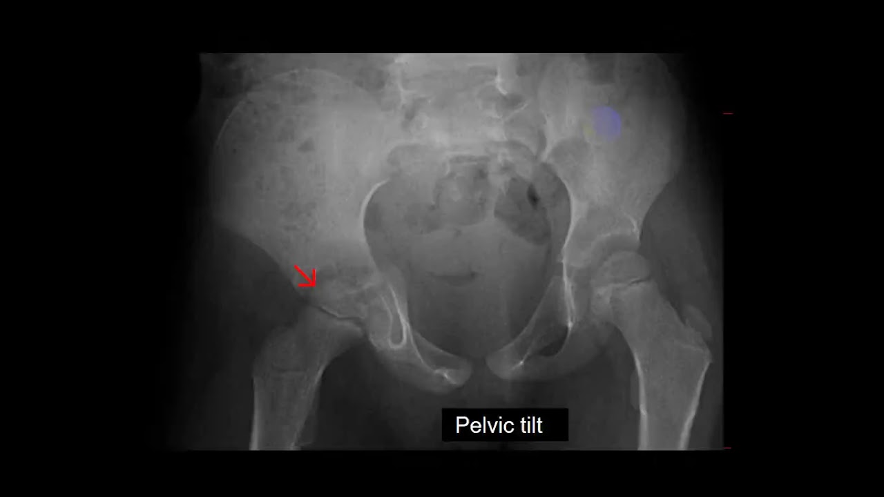 pediatric diagnosis Prof  Osama Hegazy