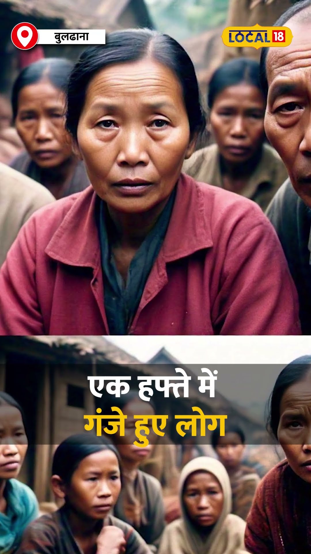 महाराष्ट्र के 3 गांवों में अचानक हुए गंजेपन के मामले, जानिए क्या है कारण! #local18shorts