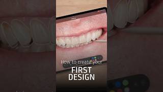 2D Smile Designs in SMILECLOUD