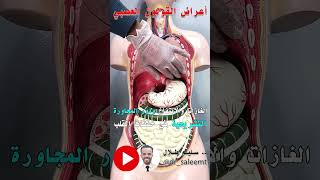 توضيح سبب حدوث خفقات القلب المتكررة والنغزات