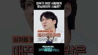 [맛보기Tip숟가락] ㅣ하얀피부는 레이저토닝이 필요없는거 아니에요? #피코토닝  #피코  #토닝  #시술추천 #시술