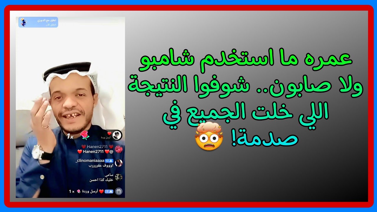 عبدو شوفوا النتيجة اللي خلت الجميع في صدمة #ترند