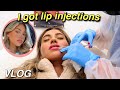 I GOT LIP INJECTIONS VLOG!! *full experience, before & after* ft. LaserAway