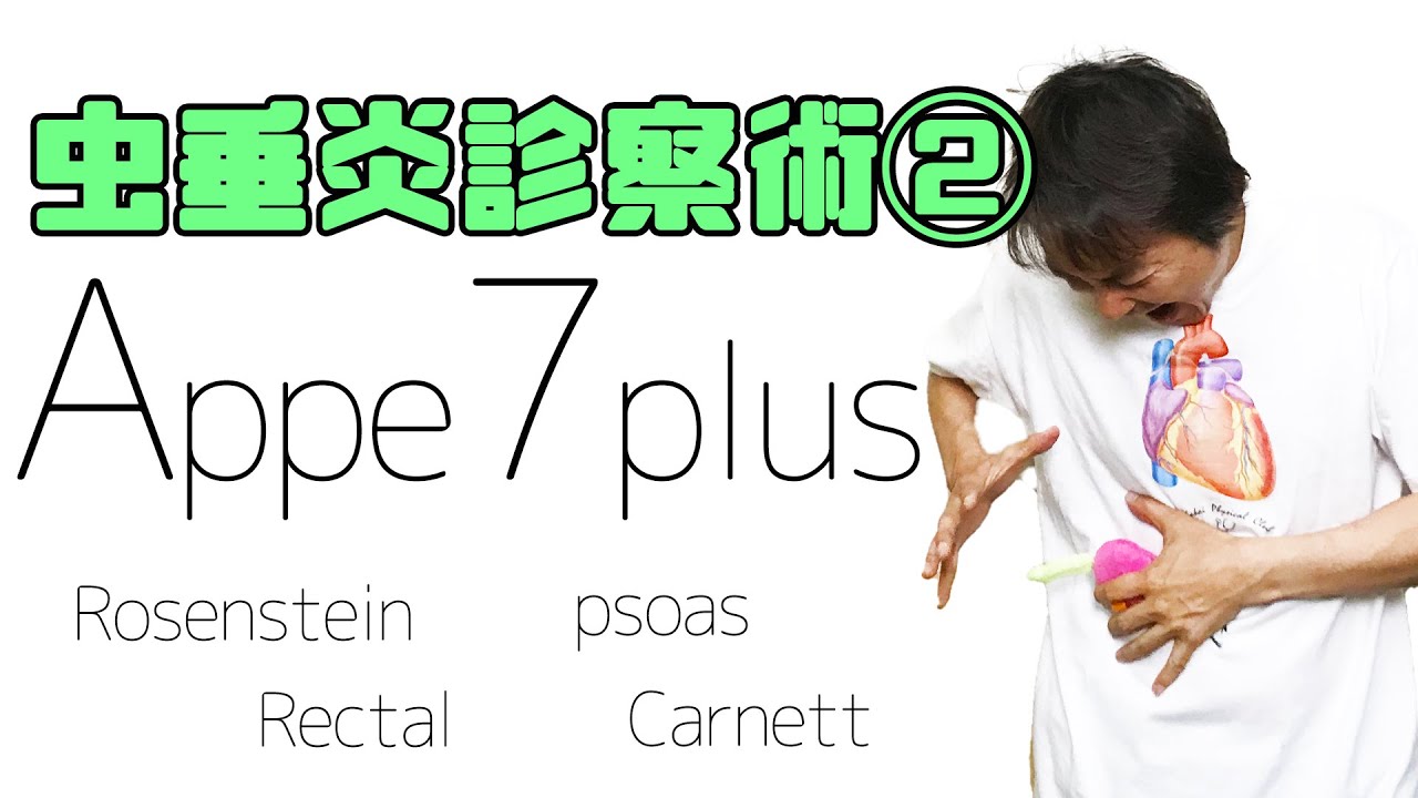 Rosenstein徴候 腸腰筋 Psoas 徴候 直腸診 Carnett徴候 虫垂炎appendicitis Part 4 Youtube