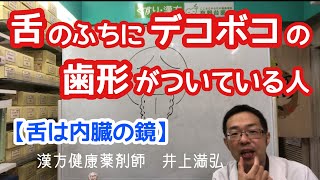 舌のふちにデコボコの歯形がついている人　【舌診】