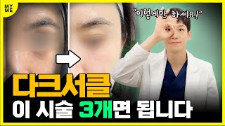 눈가 눈밑 다크써클 시술🔍아이볼뉴머 아이쥬베룩 아이리쥬란+보톡스까지