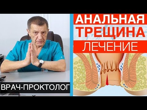 АНАЛЬНАЯ ТРЕЩИНА (ЧАСТЬ 2) - ЛЕЧЕНИЕ и СНЯТИЕ СИМПТОМОВ.