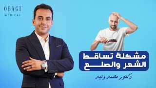 مشكلة تساقط الشعر والصلع - دكتور| محمد وليد