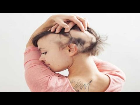 When You Have Thin Brittle Nails Insomnia And Hair Loss Eat This