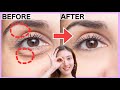 Make Your Eyes Bigger, Reduce Dark Circles, Eye Bags, Wrinkles | Eye Exercise for All Eye Types