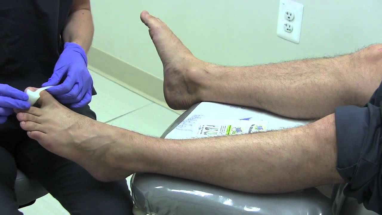 Dr  Jill's Gel Bunion Spreader Combo