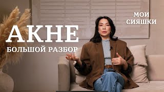 Забудьте об АКНЕ: Советы от Жанны Нуралы  #Акне #чистаякожа #лечениеакне #причиныакне