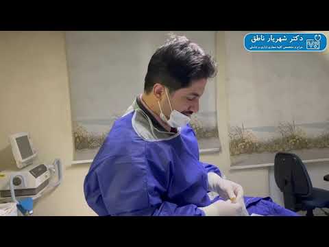 نحوه سوند گذاری از راه مثانه