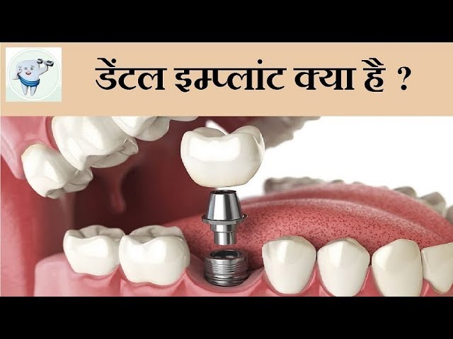 7 Strange Facts About top dental clinic in Dwarka