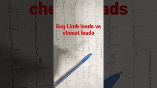 ECG Limb leads vs cheast leads By Babita#shorts #ecg