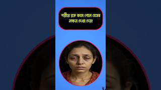 শরীরের রক্ত কমে গেলে যেসব লক্ষণ দেখা দেয়। #healthadvice #shortsfeed #healthandwellness