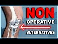 5 nonoperative alternatives to knee replacement what you need to know