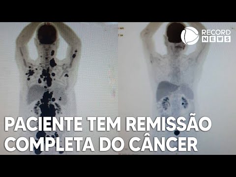 Vídeo: O enigma do relâmpago