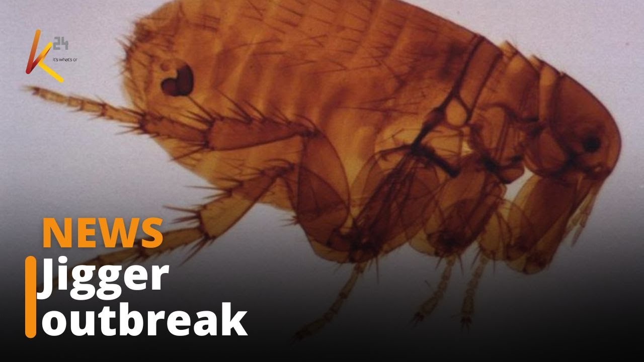 School children forced to stay home due to a jigger outbreak