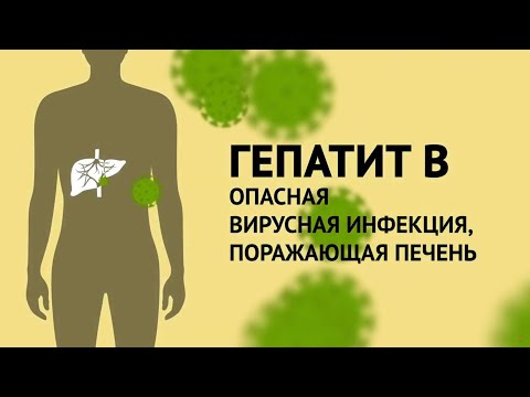 Видео: Что может быть следствием гепатита В?