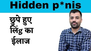 Burried Penile Syndrome Hidden