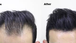 Buy THICK FIBER Hair Building Fibers Black 25gm  Hair Fibers For Thin   Fine Hair Hair Thickening Fibers for Men  Women Online at Low Prices in  India  Amazonin