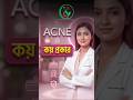 স্থায়ীভাবে ব্রণের গর্ত ও দাগ দূর করার আধুনিক লেজার ট্রিটমেন্ট। Permanent Acne &amp; Scar Removal