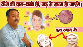 200% चेहरे से सारे दाग-धब्बे मिटायें। Remove pimples from face by panchagavya. RAJIV DIXIT