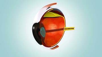 Unveiling the Significance of Axial Length Measurements and Eye Elongation