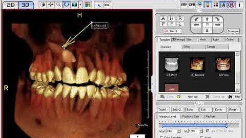 Annotate Text and Add Arrow Labels
