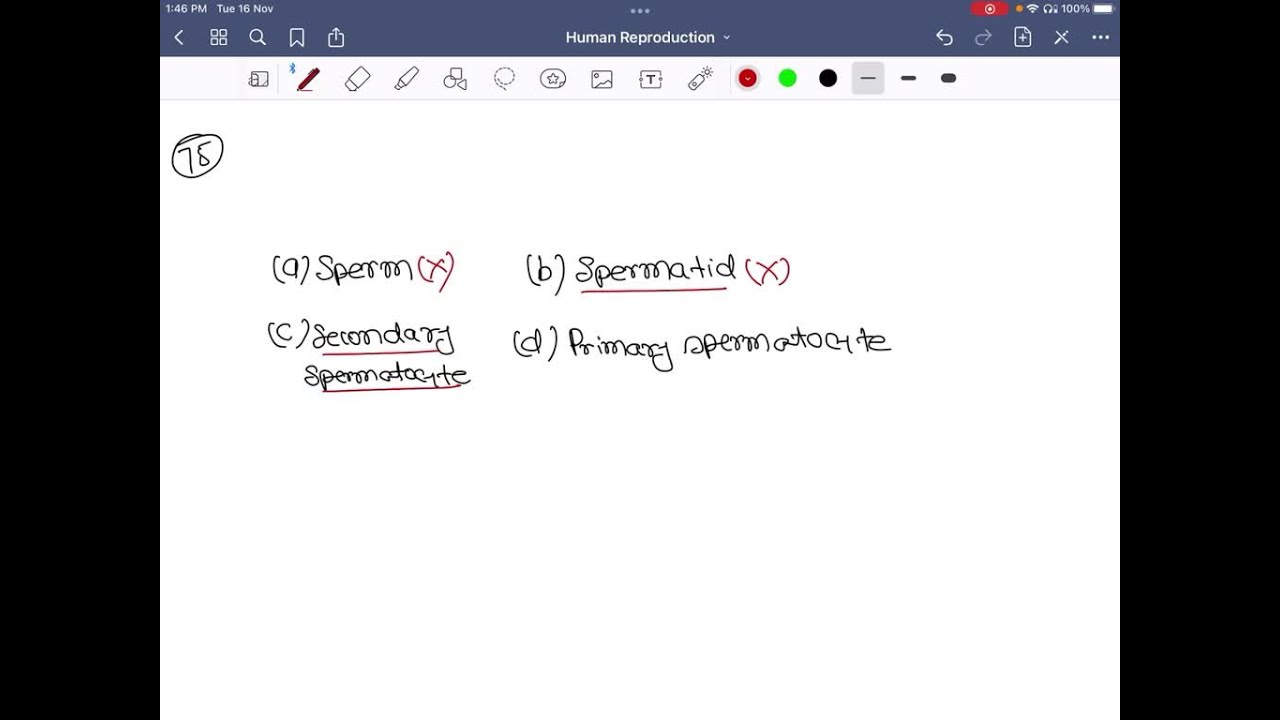 The ploidy of spermatogonia, primary spermatocyte, secondary spermatocyte and spermatid is (a) 2 …