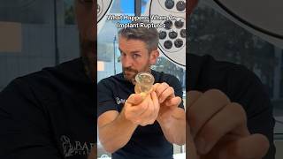 What Happens When Implants Break?