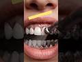 Instant teeth whitening at home 😁✨#Teethwhitening #smilecare #brightsmile #trendingshorts