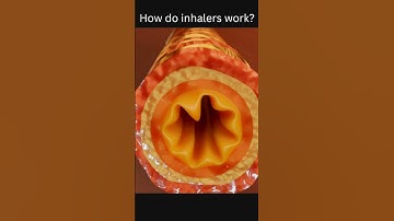 Thumbnail of How do inhalers work?.