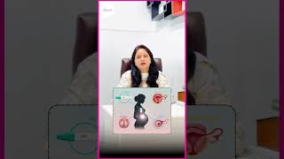 Mummy Makeover Kya Hota Hai? – What Is a Mommy Makeover and Who Is It For? #MommyMakeover