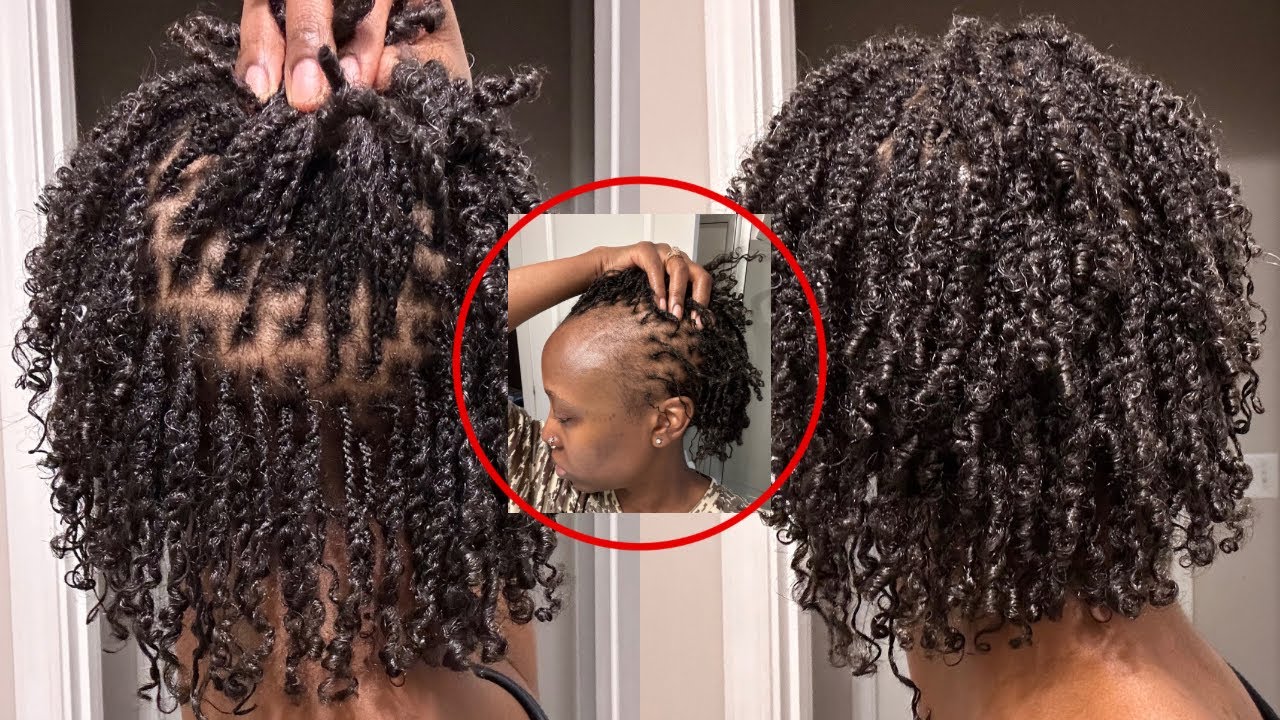 MICROLOCS INSTALL |Postpartum Alopecia | Postpartum Hairloss