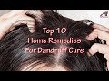 10 Home Remedies For Dandruff Cure 💇 Dandruff Treatment at Home👴