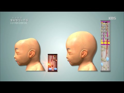 생로병사의 비밀 - 브라질發 지카 바이러스와 소두증의 연관성.20160518