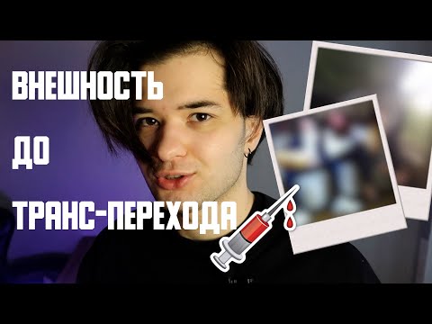 Мои фото до гормонотерапии! FtM / ФтМ