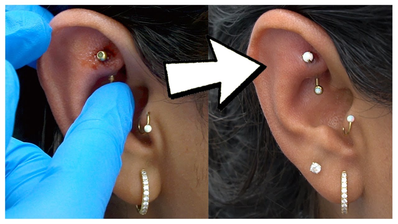 Bye Bye Bumps Rook Piercing Gone Right S4 Ep14 Youtube 