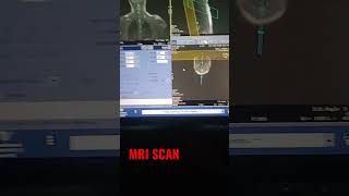 The MRI machine  strong magnet, radio transmitter  loud clicking sounds. #mriscan #scan #shotsvideo
