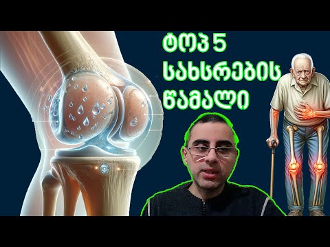საუკეთესო 5 დანამატი სახსრების ტკივილისთვის