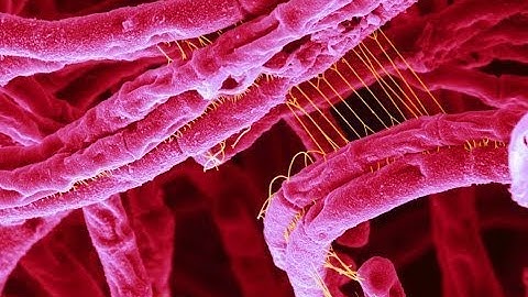 What is Anthrax Disease? (720p)