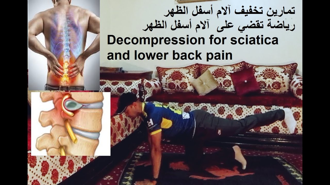 Decompression for sciatica and lower back painرياضة تقضي على آلام أسفل ...